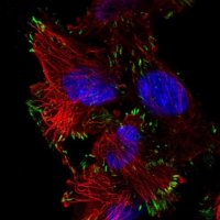 Anti-ASAH2 antibody produced in rabbit 