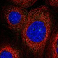 Anti-ASAP1 antibody produced in rabbit