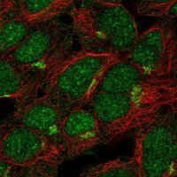 Anti-ASB13 antibody produced in rabbit 
