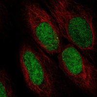 Anti-ASF1A antibody produced in rabbit 