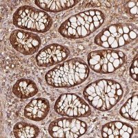 Anti-ASMTL antibody produced in rabbit 