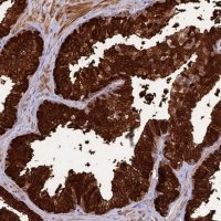 Anti-ASPDH antibody produced in rabbit 