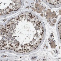 Anti-ATAD2 antibody produced in rabbit HPA019860-100UL