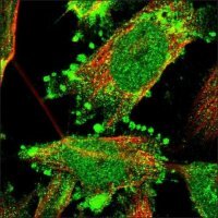 Anti-ATAD2 antibody produced in rabbit HPA019860-100UL
