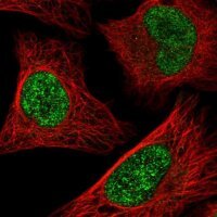 Anti-ATF1 antibody produced in rabbit 