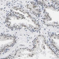 Anti-ATF2 antibody produced in rabbit 