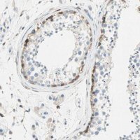 Anti-ATF6 antibody produced in rabbit 