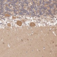 Anti-ATG2B antibody produced in rabbit 