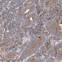 Anti-ATP11B antibody produced in rabbit