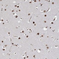Anti-ATP11B antibody produced in rabbit