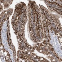 Anti-ATP11C antibody produced in rabbit 