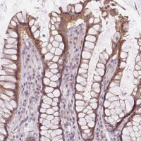 Anti-ATP1B3 antibody produced in rabbit 