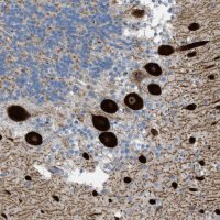 Anti-ATP2A3 antibody produced in rabbit 