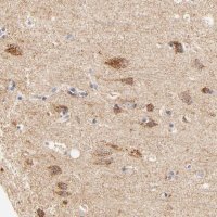 Anti-ATP5D antibody produced in rabbit 