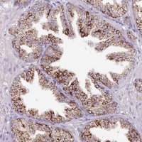 Anti-ATP6V1E2 antibody produced in rabbit HPA052784-100UL