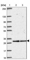 Anti-ATP6V1E2 antibody produced in rabbit HPA052784-100UL