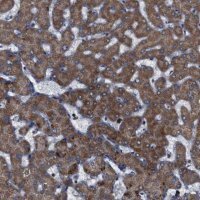 Anti-ATP7B antibody produced in rabbit 