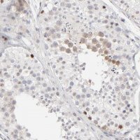 Anti-AURKA antibody produced in rabbit 