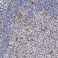 Anti-AURKA antibody produced in rabbit 