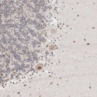 Anti-AUTS2 antibody produced in rabbit 