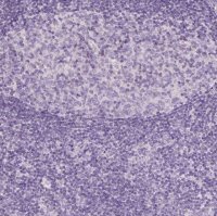 Anti-AWAT2 antibody produced in rabbit 
