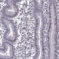 Anti-BACH1 antibody produced in rabbit 