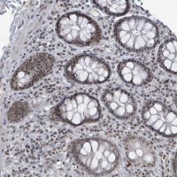 Anti-BANP antibody produced in rabbit 