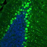 Anti-BCAR1 antibody produced in rabbit
