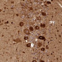 Anti-BCDIN3D antibody produced in rabbit 