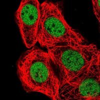 Anti-BCL7B antibody produced in rabbit 