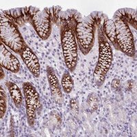 Anti-BDKRB2 antibody produced in rabbit 