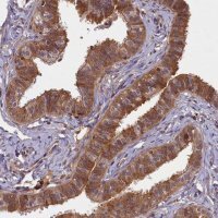 Anti-BICD1 antibody produced in rabbit