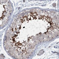 Anti-BIVM antibody produced in rabbit 