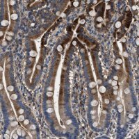 Anti-BLOC1S1 antibody produced in rabbit