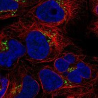 Anti-BLOC1S3 antibody produced in rabbit 