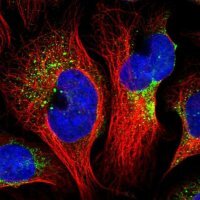 Anti-BLOC1S4 antibody produced in rabbit 