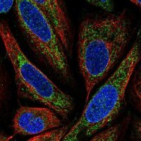 Anti-BMP6 antibody produced in rabbit 