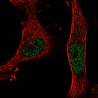 Anti-BNC2 antibody produced in rabbit 