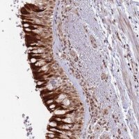 Anti-BOD1L1 antibody produced in rabbit 