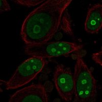 Anti-BOP1 antibody produced in rabbit 