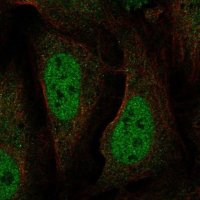 Anti-BRAT1 antibody produced in rabbit 