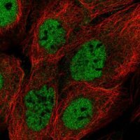 Anti-BRCC3 antibody produced in rabbit 