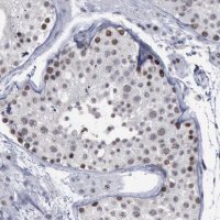 Anti-BRD1 antibody produced in rabbit 