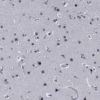 Anti-BRD1 antibody produced in rabbit 