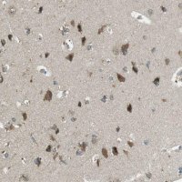 Anti-BRI3BP antibody produced in rabbit 