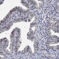 Anti-BRIX1 antibody produced in rabbit 