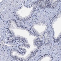 Anti-BRIX1 antibody produced in rabbit 