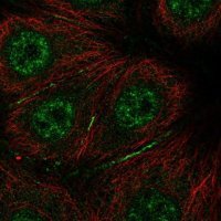 Anti-BRK1 antibody produced in rabbit 