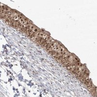 Anti-BROX antibody produced in rabbit 