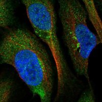 Anti-BROX antibody produced in rabbit 
